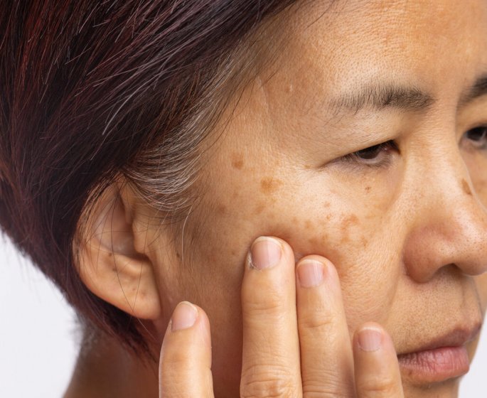 3 effets inattendus de la menopause sur votre peau (et ce n-est pas les rides !)