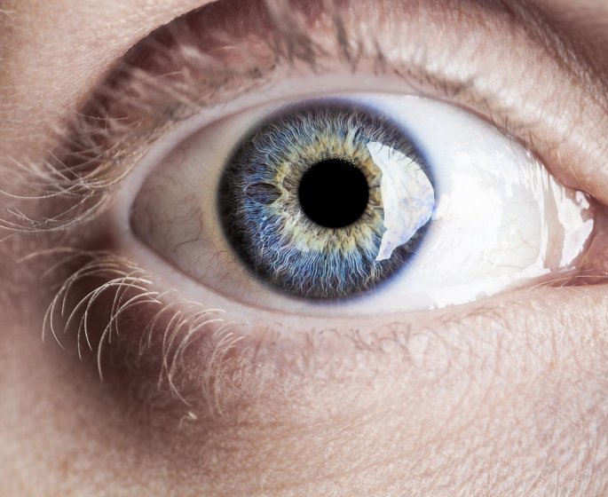 Uveite ou melanome de l-uvee : la difference