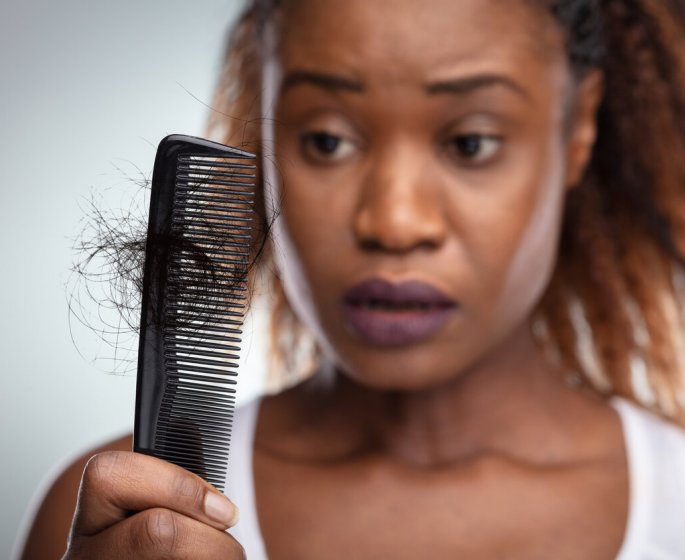 Alopecie (perte de cheveux) : ces coiffures a eviter