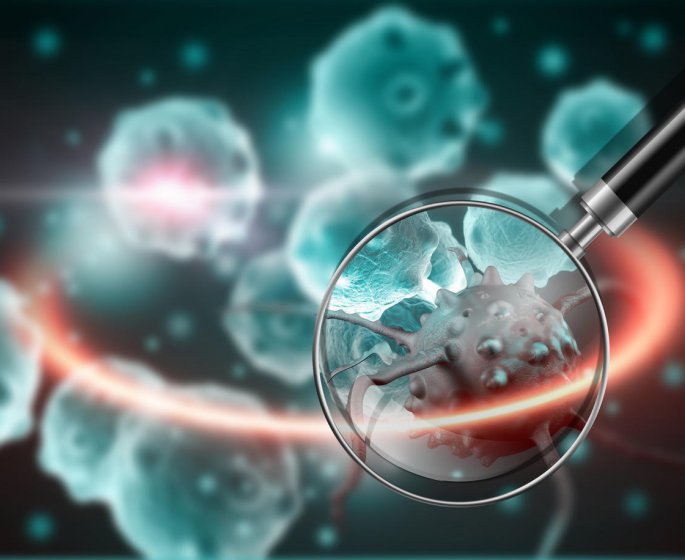 Cancer foudroyant de la peau : la definition