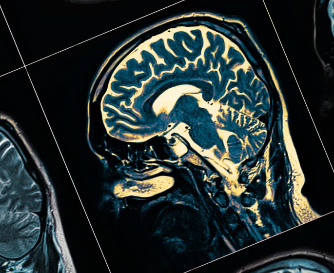 Une lumiere par infrarouge ralentit la maladie de parkinson