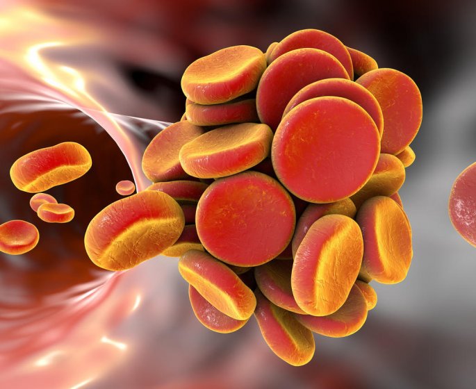 Thrombose : moins de risques avec le vaccin qu-en ayant le coronavirus ?