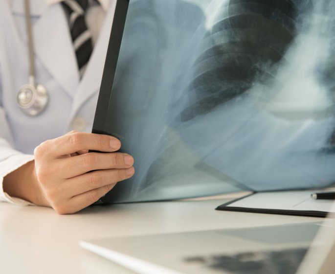 Densitometrie osseuse : comment se faire rembourser ? 