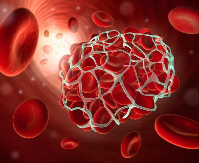 Embolie pulmonaire : quels sont ses symptomes, causes, traitements, signes et quelle est sa duree ?