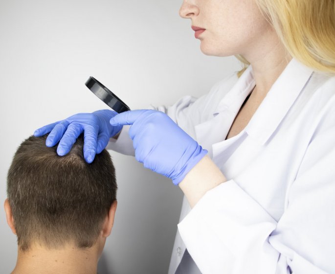 Greffe de cheveux en France : prix, risque... ce qu-il faut savoir