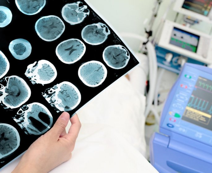 Le stress, une cause de cancer du cerveau ?