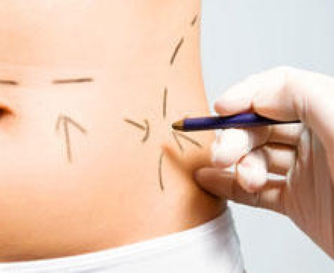 Chirurgie plastique : faut-il se faire operer a l-etranger ?