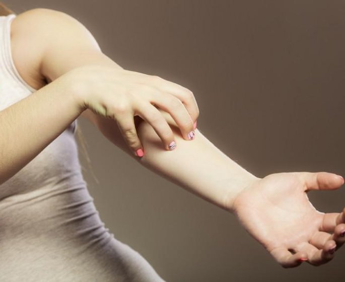 Urticaire chronique : c-est quoi ?