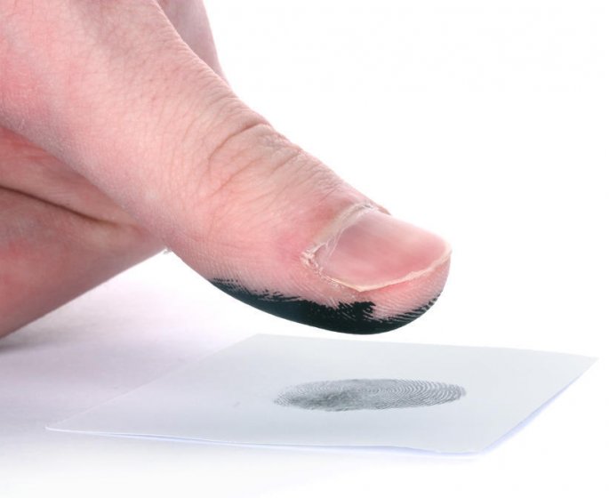 Ces personnes qui n-ont pas d-empreintes digitales