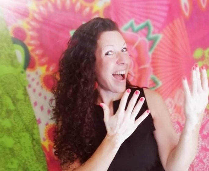 Vitiligo : &quot;J’ai un regard artistique sur mon vitiligo&quot;