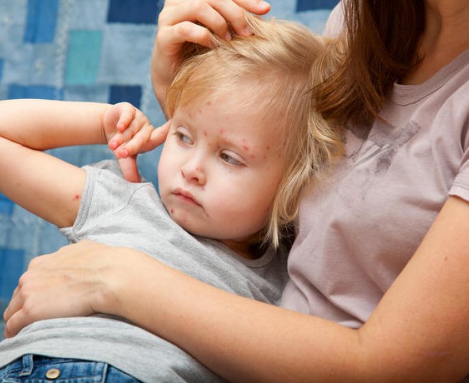 Diarrhee : un symptome normal de varicelle ?