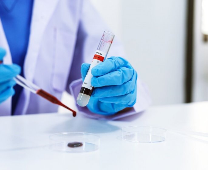 Demence : trop de bon cholesterol accroit les risques