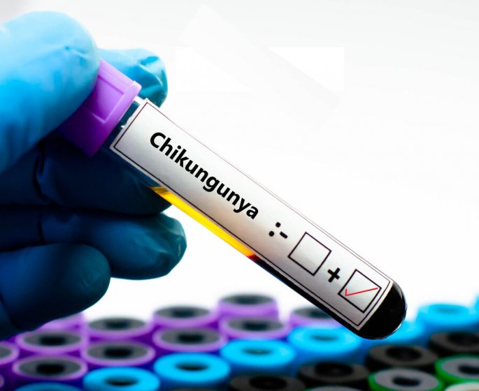Chikungunya : le vaccin contre-indique en France pour les plus de 65 ans alors que les victimes du moustique se multiplient