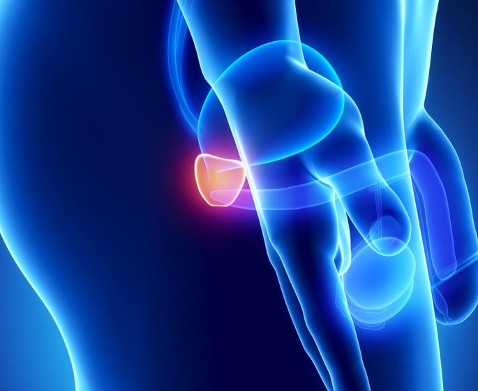 Prostate : Ou faire un depistage ?