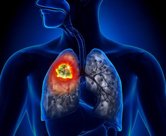 Ce gaz inodore dans votre maison qui augmente le risque de cancer du poumon