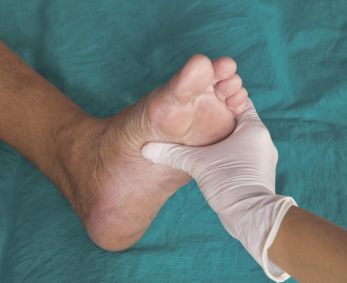 Complication du diabete : le pied diabetique