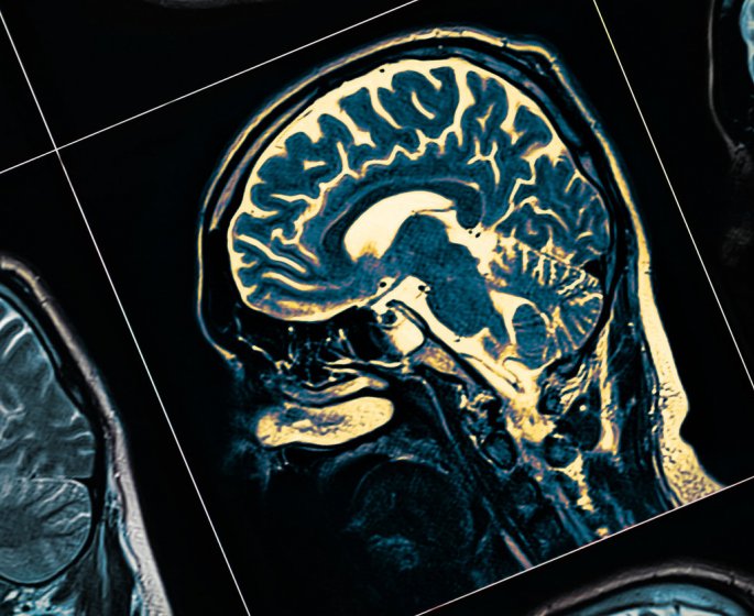 Confinement : comment gerer le quotidien avec une personne atteinte d’Alzheimer ?