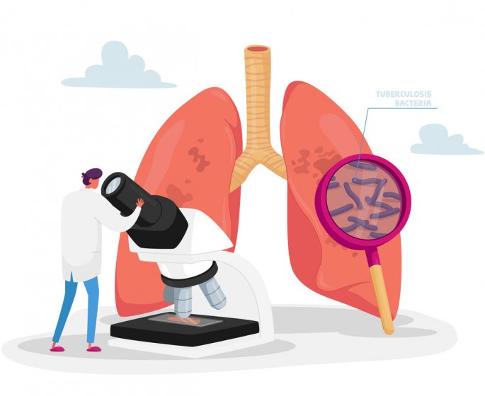 Tuberculose : un premier test de diagnostic approuve par l-OMS