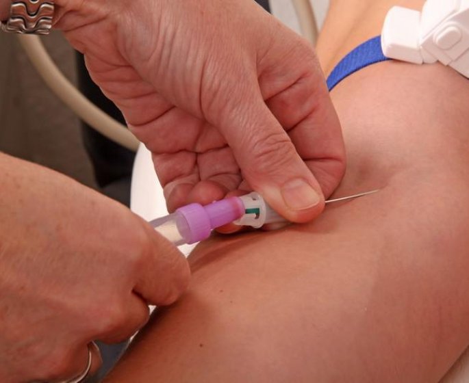 Triglycerides : les taux normaux