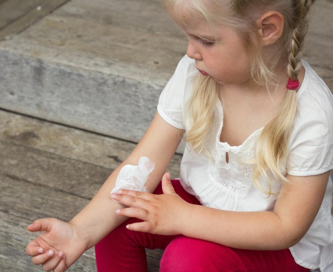 Urticaire aigue de l-enfant : un risque de contagion ?