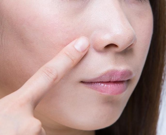 Cancer des sinus : 7 symptomes d-alerte