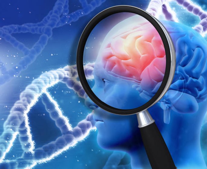 Maladie d’Alzheimer : deux nouveaux genes responsables identifies 