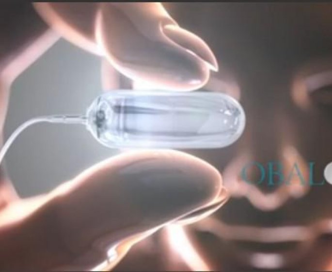 Image : Obalon, la nouvelle capsule qui vous fait maigrir