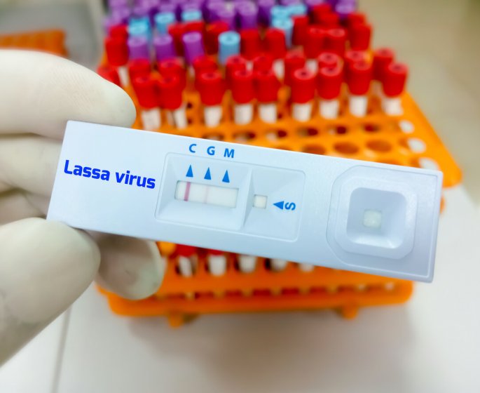 Fievre de Lassa : un premier cas en France, faut-il s’inquieter ?