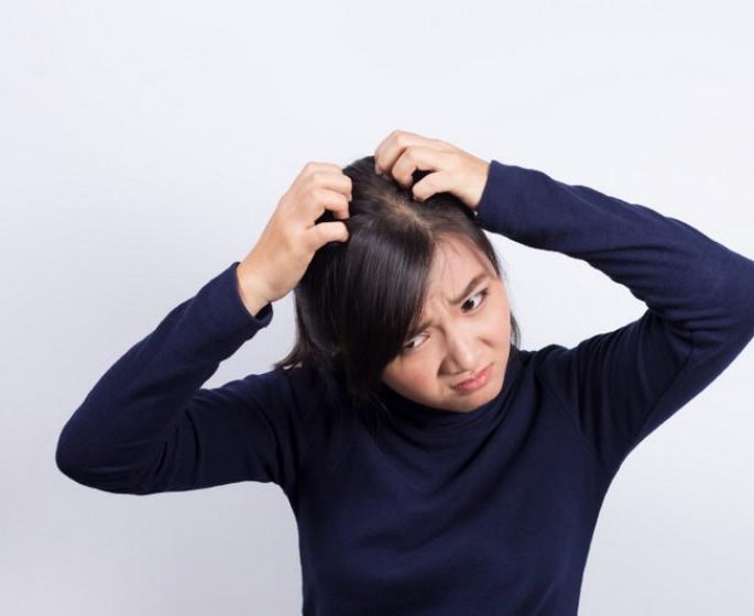 Psoriasis du cuir chevelu : comment le reconnaitre et le soigner