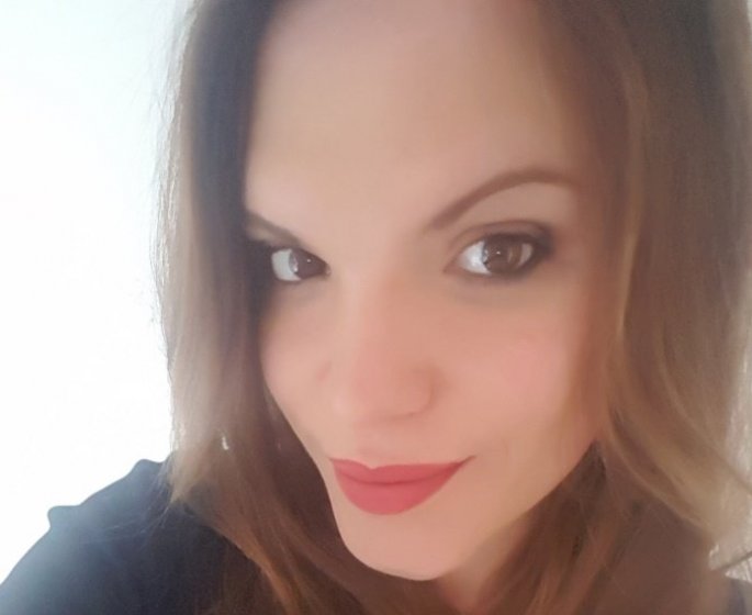 Alopecie : “J’ai porte sept perruques depuis mes 12 ans”
