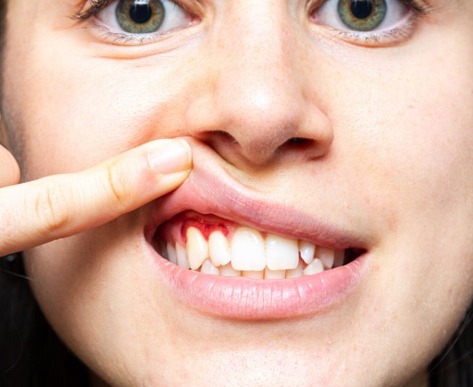 Ces fruits sont les meilleurs pour les gencives et les dents selon une etude !
