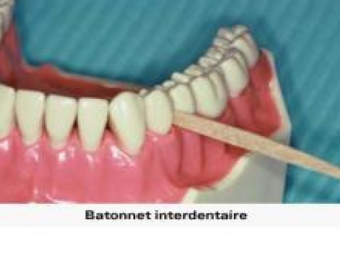 L’hygiene bucco-dentaire de l’adulte