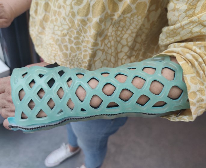 Fracture, entorse : un “platre” alveole plus pratique en ete !