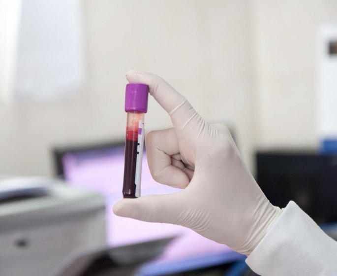Ferritine a jeun : les valeurs normales