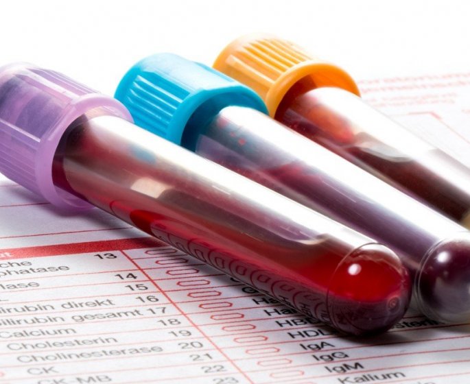 6 raisons cachees qui peuvent faire exploser vos Gamma GT