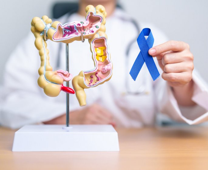 Cancer colorectal (colon ou rectum) : a quel age est-on plus a risque ? 