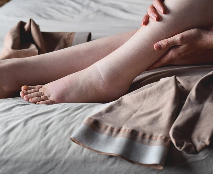 Comment choisir entre les collants, les bas, et les chaussettes de contention ?