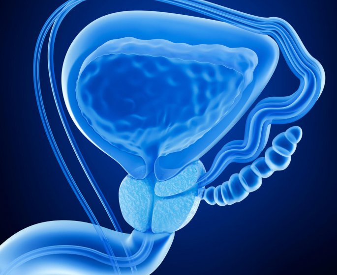 Adenome prostatique : le traitement medicamenteux