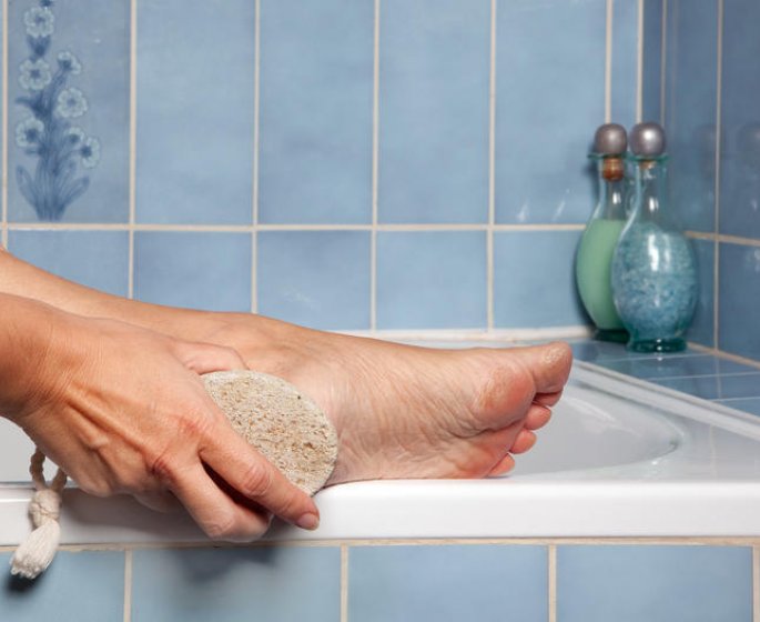 3 solutions pour soigner un durillon