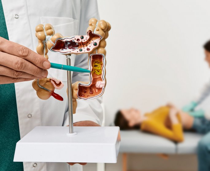 Cancer colorectal : devez-vous realiser un depistage ? 