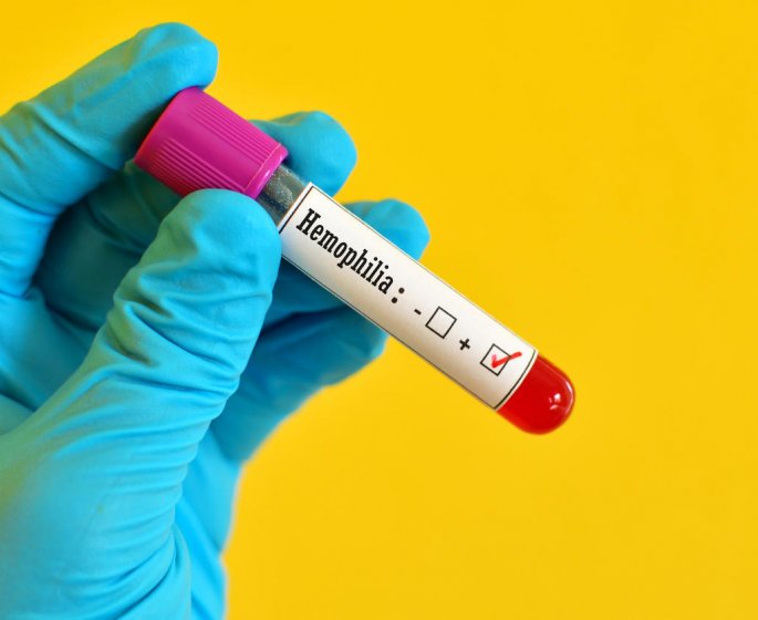 Femme hemophile : pourquoi ses regles sont abondantes ?