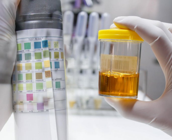 Urine orange : 3 causes possibles