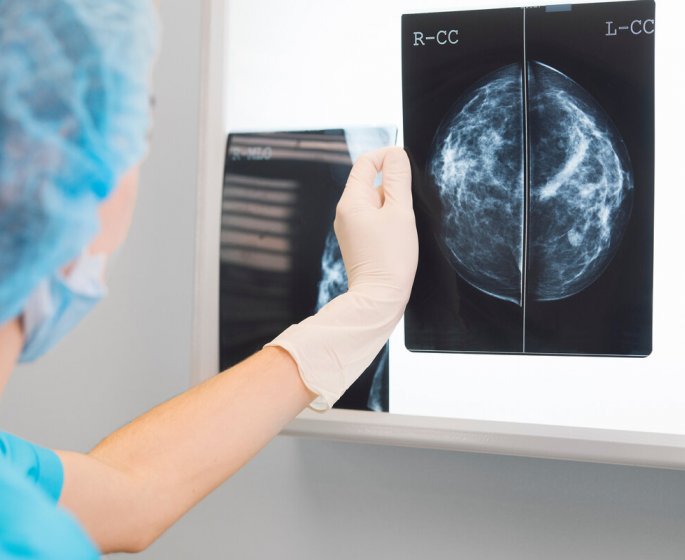 Cancer du sein : une exposition aux particules fines augmente les risques
