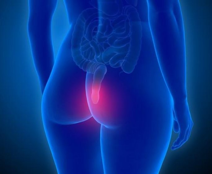 Cancer de l-anus : quels sont les symptomes ?