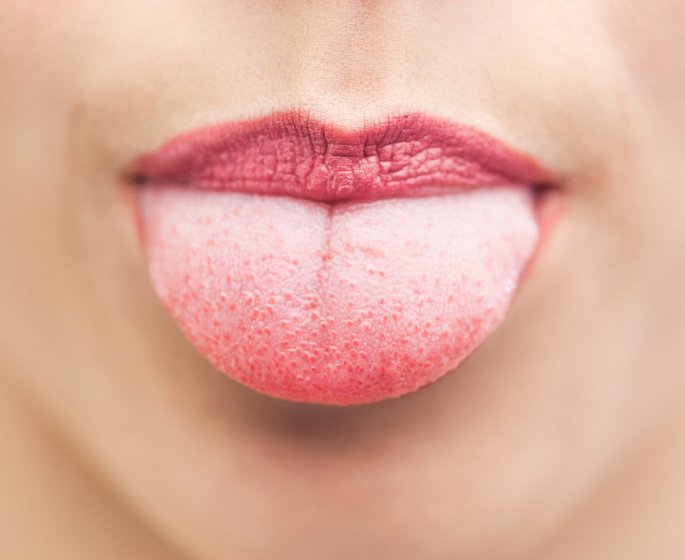 Apnee du sommeil : les langues "grasses" seraient responsables des ronflements