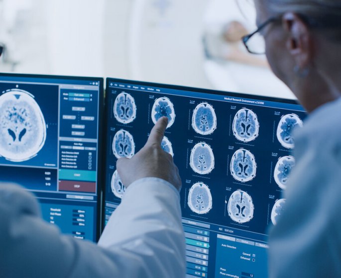 Sante cardiovasculaire et maladie d’Alzheimer : quel lien ?
