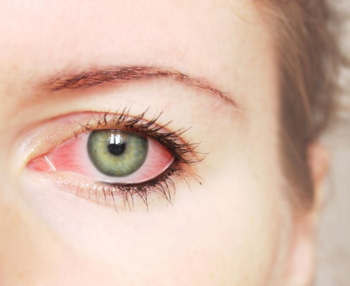 Pourquoi j’ai les yeux rouges ?