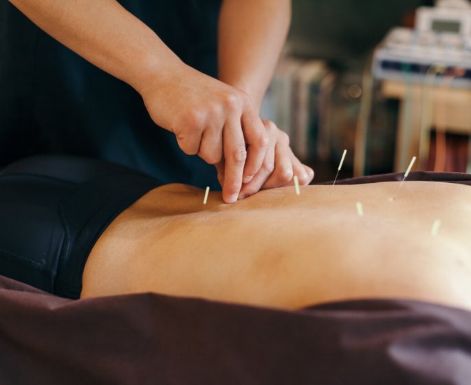 3 utilisations de l-acupuncture validees par le medecin