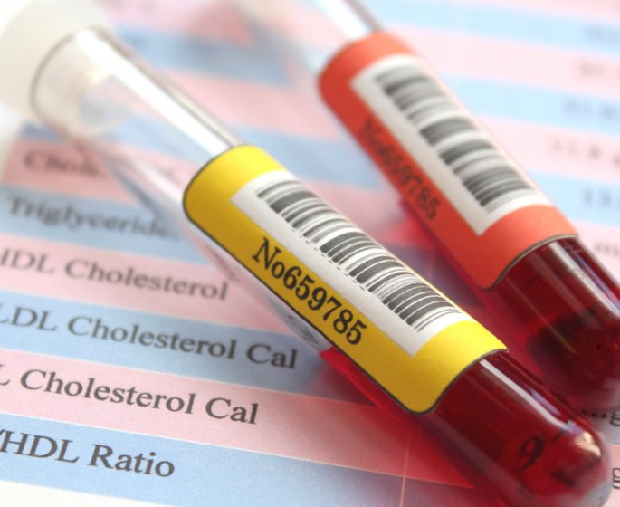Cholesterol : il peut annoncer une maladie cardiaque 20 ans avant