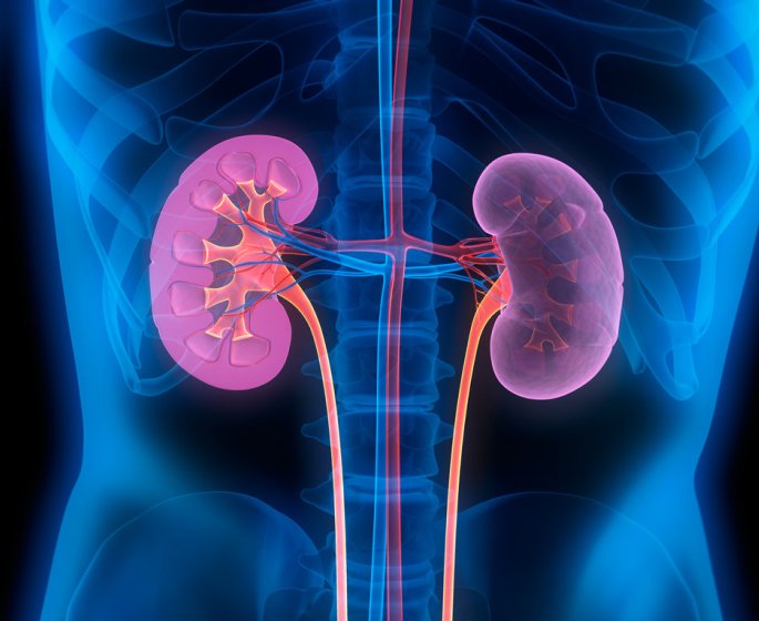Lithiase urinaire (calculs urinaires) : symptomes, traitements, causes